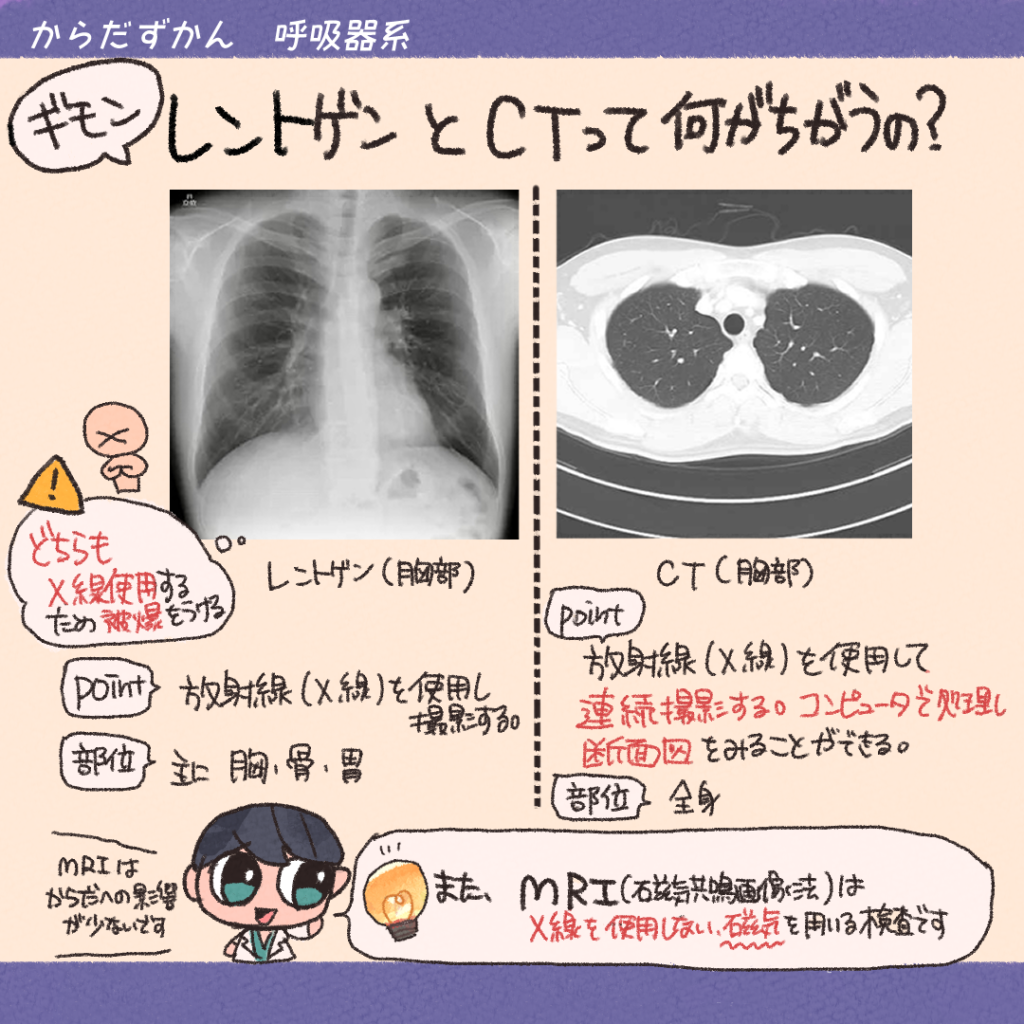 胸部 x 線 検査